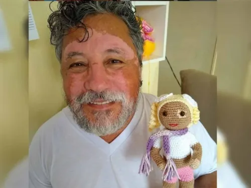 Viejito teje muñecas ‘con vitiligo’, así alienta a niños con este padecimiento