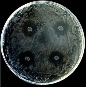 Cero Caries: Científicos descubren bacteria que impide a la caries reproducirse