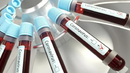 Científicos en todo el mundo trabajan para tener vacuna contra coronavirus cuanto antes