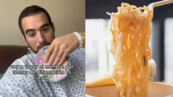Operan a hombre de emergencia y pierde un trozo de intestino por comer sopa instantánea