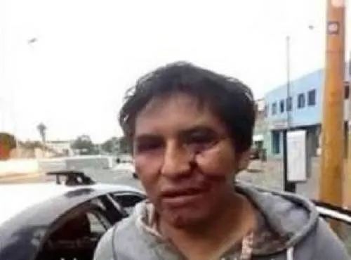 Golpean y asaltan a hombre en Barrio de San Antonio