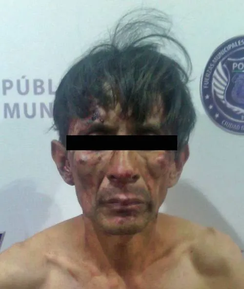 Detiene SSPTM a probable multidelincuente; ya se encuentra en prisión