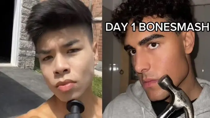 Bonesmashing