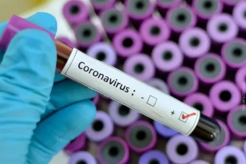 Coronavirus, lo que debes saber