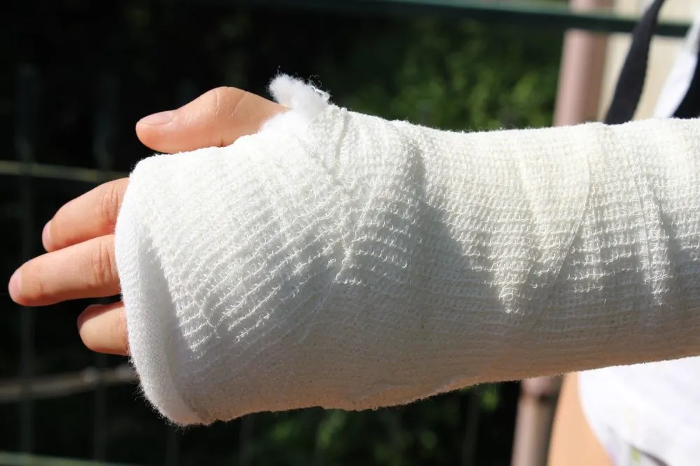 Fractura