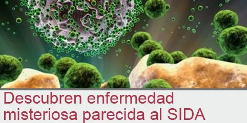 Descubren enfermedad  misteriosa parecida al SIDA
