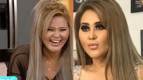 Gomita lo vuelve a hacer, se opera otra vez y el resultado causa polémica