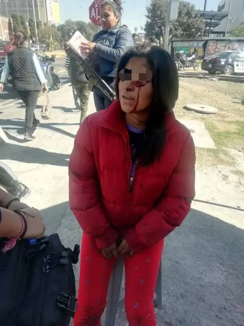 Le roban su bici y la hieren con un cúter en el rostro