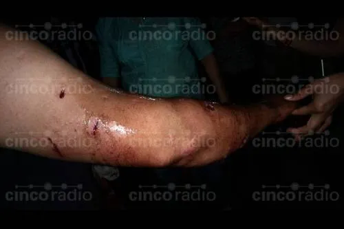 VIDEO: Con ayuda de un rottweiler, sujeto asalta a transeúnte en la colonia Guadalupe Victoria