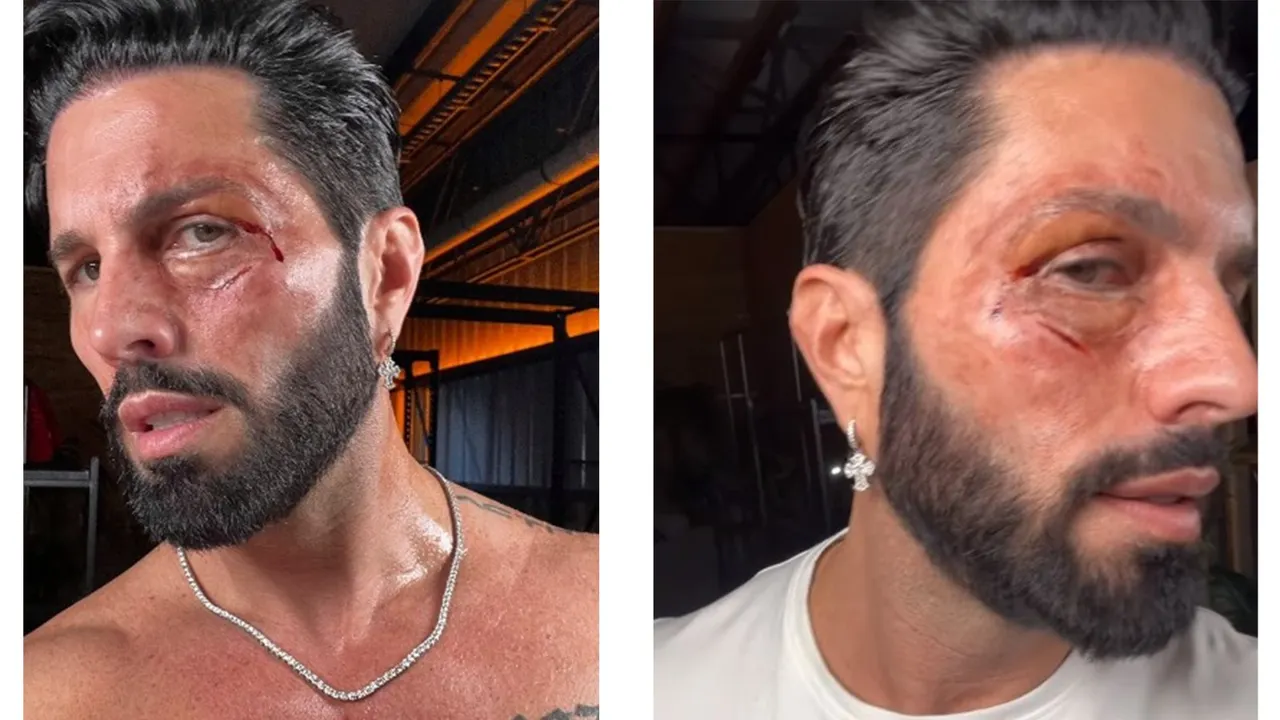 Poncho de Nigris aparece con el rostro golpeado