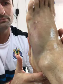 Pulido jugó infiltrado ante América y Cruz Azul