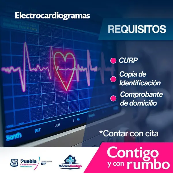 electrocardiograma