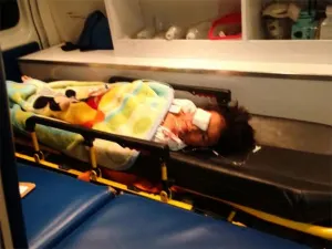 Niño podría perder un ojo tras ser mordido por un perro