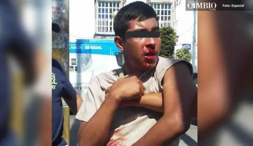 Golpean a asaltante en San Francisco Totimehuacan