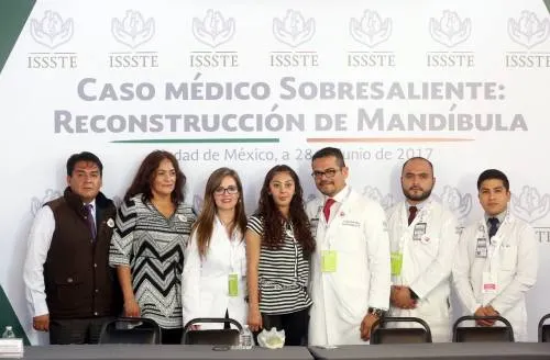 Poblana recibe implante de prótesis total de mandíbula, el segundo en el mundo: ISSSTE
