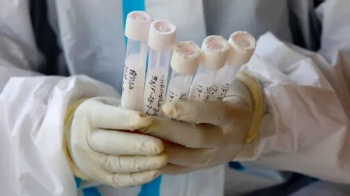 OMS descarta que el coronavirus se transmita por la comida