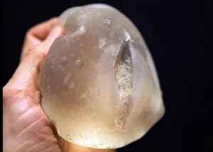 Brasil prohíbe importación de implantes franceses