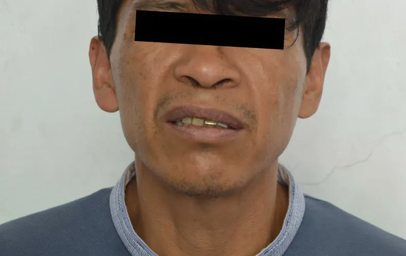 Imagen del artículo