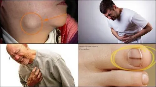 20 síntomas indican que puedes tener cáncer sin saberlo