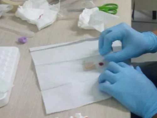 SSA emite aviso preventivo de brote en infecciones por contaminación de nutrición parenteral