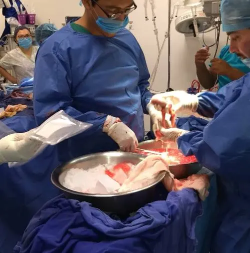 Beneficia donación de órganos del ISSSTE a pacientes de la Ciudad de México, León y Puebla