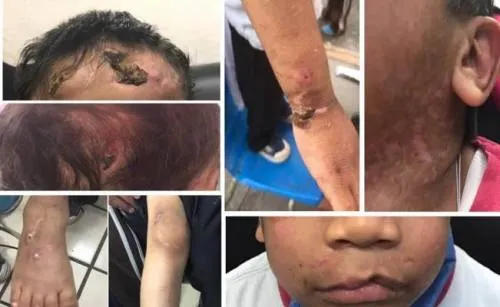 Abuela que torturó a su nieta también lo hizo con otro menor de 4 años