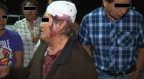 Inquilinos golpean a caseros en San Pedro Cholula