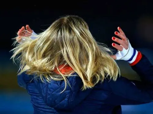 Robo de pelo, un crimen mundial que ha ido en aumento