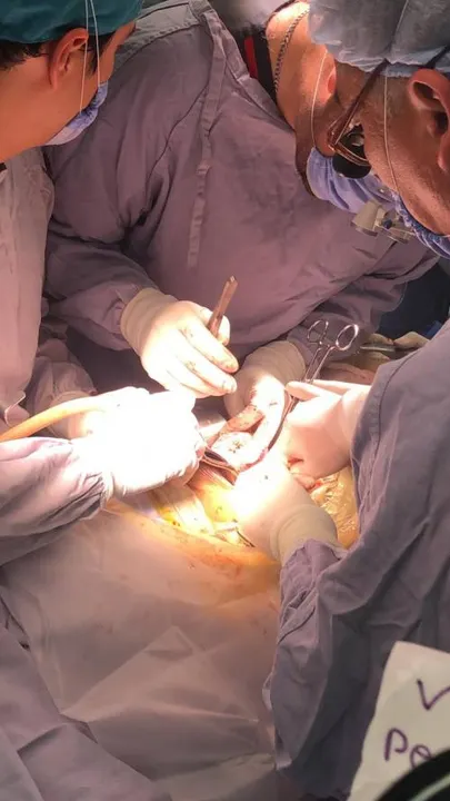 Secretaría de Salud realiza exitoso  trasplante de riñón en el Hospital General del Sur
