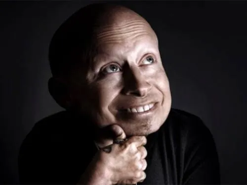 Fallece Verne Troyer, el ‘Mini-Me’ de ‘Austin Powers