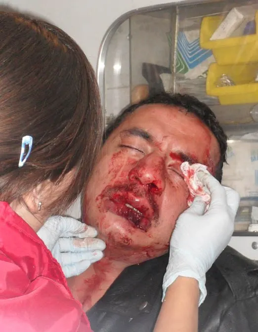 Un detenido por robo luego de los hechos en Texmelucan