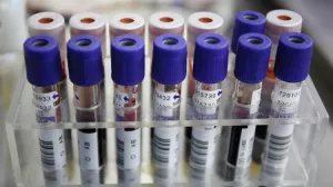 Empresa de EEUU busca ganarle la carrera al cáncer con pruebas rápidas de ADN