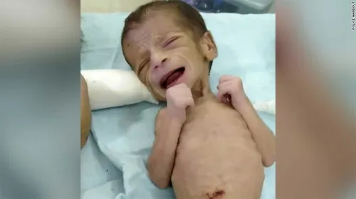 Rescatan de milagro a una recién nacida enterrada viva