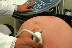 Reportan tres nuevos casos de zika al iniciar el año