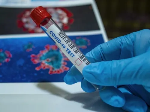 Medicamento contra covid-19 de Eli Lilly podría ser autorizado en septiembre