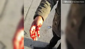 Secuestran a transportista en Texmelucan; le cortan un dedo y lo avientan en Tlaxcala