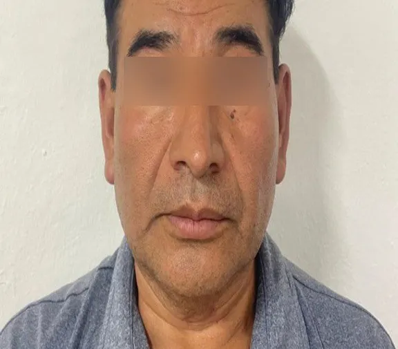 Aprehenden a sujeto por feminicidio de su pareja en Yehualtepec
