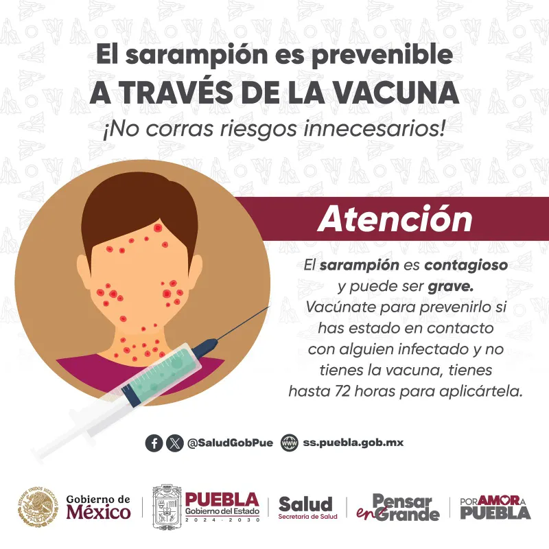 Salud estatal confirma nuevo caso de sarampión en Puebla; se refuerza vigilancia epidemiológica