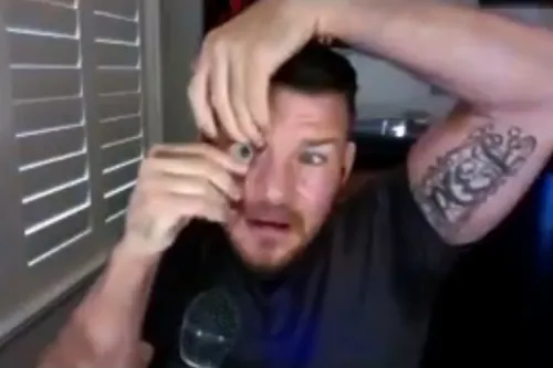 Ex peleador de la UFC se saca ojo durante entrevista en vivo
