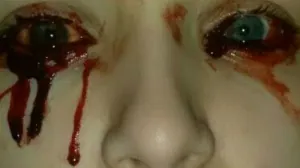 El extraño caso de la niña que llora sangre