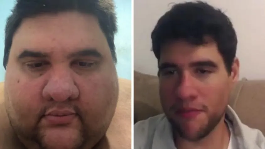 Fallece Gabriel Freitas, influencer brasileño conocido por documentar su lucha contra la obesidad