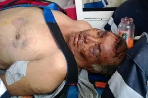 Hallan a un hombre golpeado y amordazada en el Periférico Ecológico