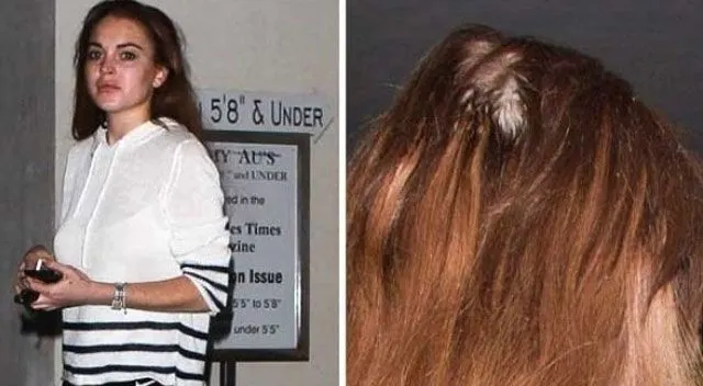 Lindsay Lohan ahora pierde… cabello