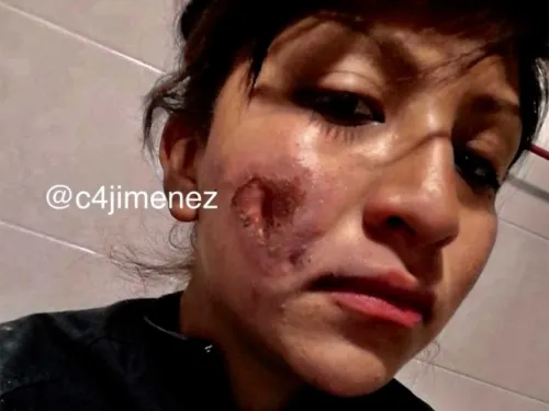 ‘Feministas me quemaron ayer y yo solo deseo poder sanar’