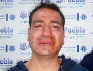 Policía Municipal aseguró a un sujeto probable responsable del delito de lesiones