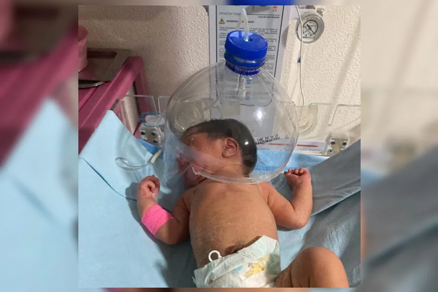 Bebe Botella Casco Cefalico Garrafon