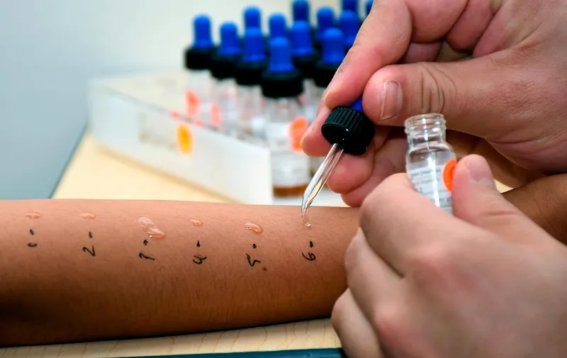 buap-hup-vacunas-sars-cov-2-alergia