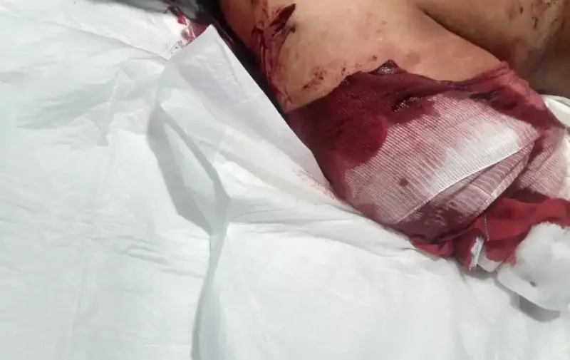 El periodista Augusto Simón Valencia de Tecamachalco sufrió un ataque la madrugada del 20 de julio por seis personas frente a su domicilio en Tochtepec, en el Triángulo Rojo de Puebla.