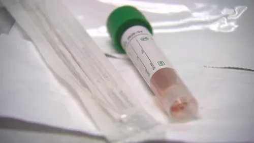 Empresa japonesa lanzará a la venta kits de prueba que pueden detectar el coronavirus en 15 minutos