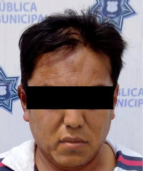 Detiene policía municipal de Puebla a hombre por lesiones
